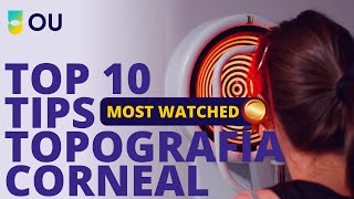 Top 10 Tips en Topografía Corneal [upl. by Eitsud]