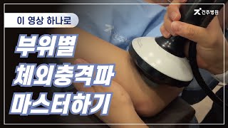 부천 건주병원영상 하나로 부위별 체외충격파 마스터하기 [upl. by Niwhsa]