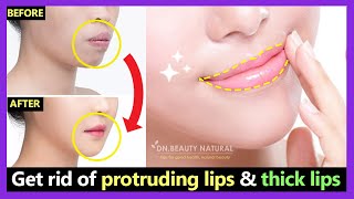 How to get rid of Protruding Mouth and Lips naturally  Make Thick lips to Thin lips with exercises [upl. by Annahtur]