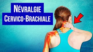 Névralgie cervicobrachiale  Symptôme et Traitement [upl. by Fusco]