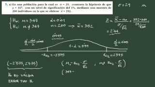 2 Contraste de hipótesis bilateral media explicación y ejemplo [upl. by Sido641]