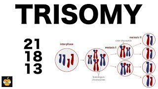 Trisomy 21 18 and 13 amp Nondisjunction Genetics [upl. by Aianat]