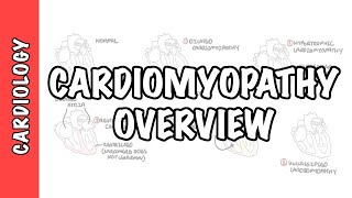 Mitral Reguritation insufficiency  Overview signs and symptoms pathophysiology treatment [upl. by Rusell648]