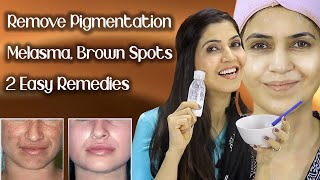 Remove Pigmentation Melasma Freckles Brown Spots  Results In One Week  Ghazal Siddique [upl. by Lundquist358]