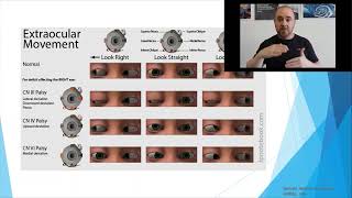 Osteopathic Considerations Eye Movements [upl. by Panta457]