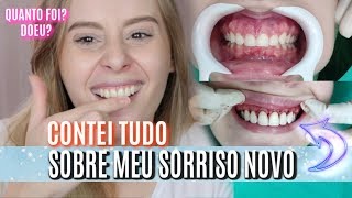 AUMENTEI MEUS DENTES doeu qual valor E MUITO MAIS [upl. by Cerell936]