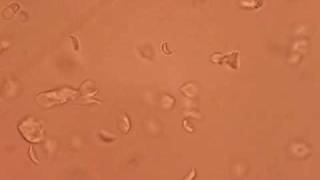 Giardia lamblia [upl. by Aicire]