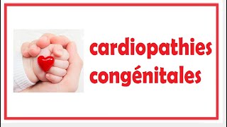 cardiopathie congénitale [upl. by Barnabe304]