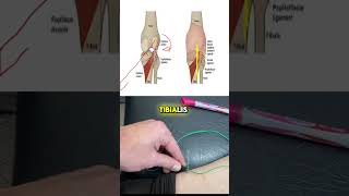 The Difference Between Tibialis Posterior amp Popliteus  Electroacupuncture [upl. by Clayborne]