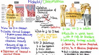 What is RicketsOsteomalacia [upl. by Lamrej397]