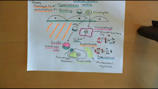 Cholesterol Metabolism Part 13 [upl. by Hays]