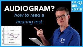 Audiogram  How to Read a Hearing Test [upl. by Lorry105]