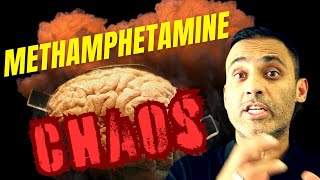 10 Ways Methamphetamine RAVAGES the BRAIN  The Neuroscientific Mechanisms [upl. by Megan]