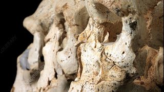 Unveiling the Neanderthal Connection How Ancient Genes Influence Autism Today [upl. by Aon]