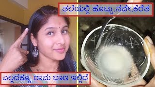 ಡ್ಯಾಂಡ್ರಫ್ ಹೋಮ್ ರೆಮಿಡೀಸ್ I Dandruff Home Remedies I Kannada Vlogs [upl. by Satsok894]