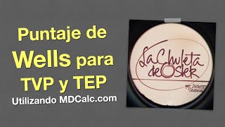 Puntaje de Wells para TVP y TEP Usando MdCalc [upl. by Linzer]