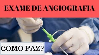 exame de angiografia como faz [upl. by Nnyloj802]