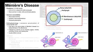 👂 Ménière’s Disease  Presentation Pathophysiology Diagnosis amp Treatment [upl. by Waylon]