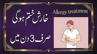 Kharish Khatam Karne Ka Wazifa  Kharish Ka Rohani Ilaj  Allergy Treatment [upl. by Lletniuq]