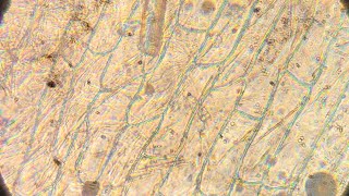 Nucleic Acid Staining by AcetoCarmin [upl. by Aynosal]