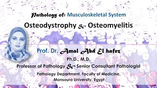 Osteodystrophy and Osteomyelitis lecture شرح محاضرة Bone diseases [upl. by Premer]