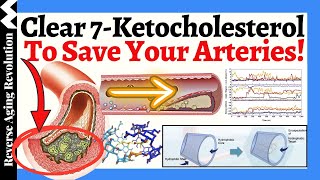 Clear 7Ketocholesterol To SAVE Your Arteries A NOVEL Approach To Heart Health [upl. by Udella]