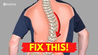 How to Relieve Your Scoliosis Back Pain in 30 SECONDS [upl. by Sharman702]