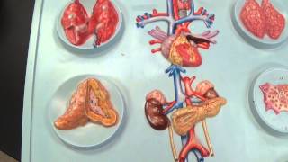 Endocrine Board Model [upl. by Carolina]