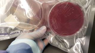 Microbiology Propionibacterium acnes anaerobic set up and colonial growth [upl. by Nnaid117]