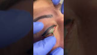 Could you handle this eyeliner tattoo removal shorts dermatologist [upl. by Aipmylo367]