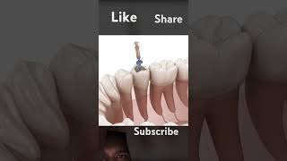 Teeth treatment tooth treatment cgi vfx doctor dentist health healthy [upl. by Nannahs]