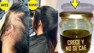 🔥El MEJOR REMEDIO CASERO PARA LA CAÍDA DEL CABELLO y para un crecimiento extremo del mismo 😱✅ [upl. by Derek86]