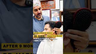 🌟 9Month Hair Transplant Transformation 💇‍♂️  FUE Method by Dr Habib ✨ [upl. by Nesyaj58]