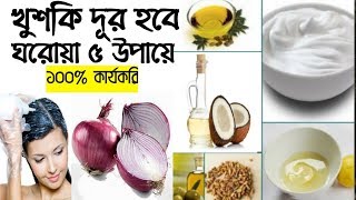 খুশকি দূর করুন ঘরোয়া ৫ উপায়ে সহজ পদ্ধতিতেKhuski dur korar upay [upl. by Cantlon]