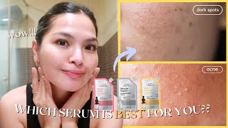 ANO ANG THE BEST SERUM FOR YOU 🤔 LUXE ORGANIX SERUMS SIMPLIFIED • Joselle Alandy [upl. by Kaenel473]