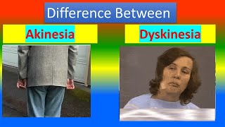 Difference between Akinesia and Dyskinesia [upl. by Acinorev]