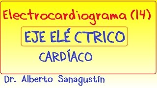 Electrocardiograma 14 Eje eléctrico del corazón cálculo [upl. by Ereveneug954]