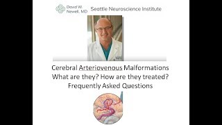 Cerebral Arteriovenous Malformations Frequently asked questions [upl. by Aoh]