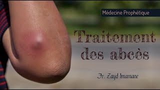 Traitement des abcès Médecine Prophètique Par Fr Zayd Imamane [upl. by Nebe]