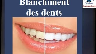 Blanchiment des dents techniques [upl. by Wan948]