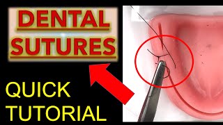 ALL SUTURES Tips to LEARN FAST Dental Suture Techniques  Oral Surgery  Dentistry Suturing [upl. by Gorrian547]