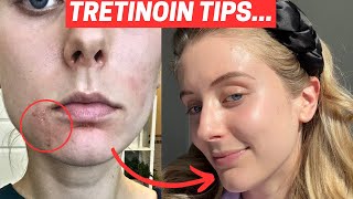 How to Use Tretinoin The Truth About Tretinoin [upl. by Tina]