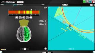 FlightscopeFocusband Introduction [upl. by Ivets382]