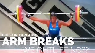 FOREARM BREAKS while lifting Weights DOCTOR Explains [upl. by Syla]