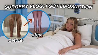 SURGERY VLOG I GOT LIPOSUCTION it was hell [upl. by Ttocs]