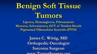 Orthopedic Oncology and Pathology Course  Benign Soft Tissue Tumors Lipoma etc  Lecture 9 [upl. by Rawdon926]