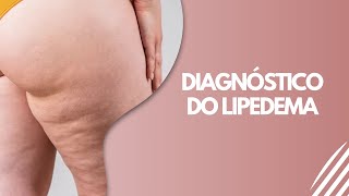 Diagnóstico do Lipedema [upl. by Nnaylime]