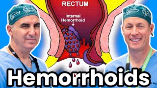 The Ultimate Treatment For Hemorrhoids [upl. by Tse743]