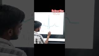 Electrocardiogram ECG  Biology viral shorts biology ecg [upl. by Welton]