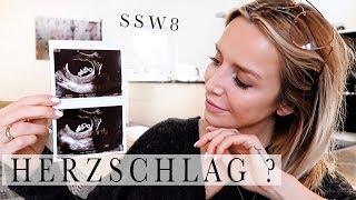 VLOG Schlägt das Herz vom Baby  1 Untersuchung nach dem Bluttest  Meine 2 Schwangerschaft [upl. by Robenia]